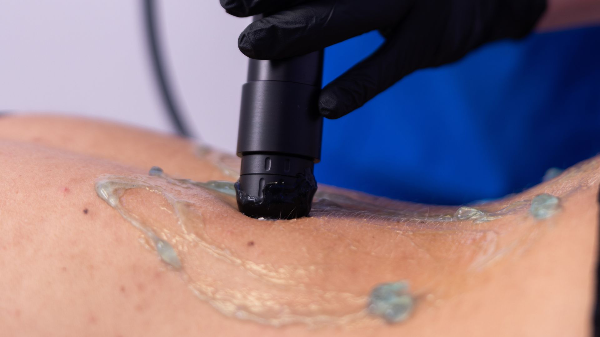 onde d'urto casalecchio di reno